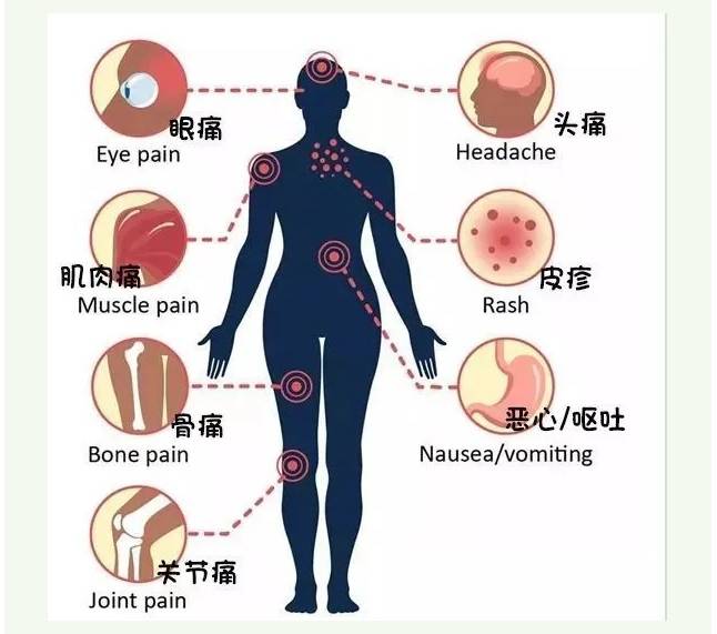 登革热症状与传播性解析，人与人的传播问题探讨