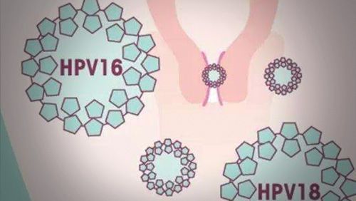 HPV病毒，理解与应对之道